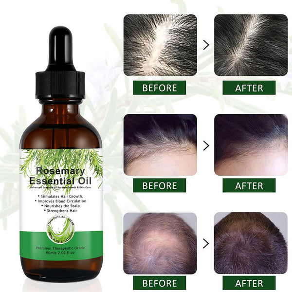 💆‍♀️ Natural Rosemary Hair Growth Serum – Revitalizing

