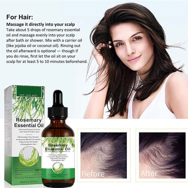 🌿 Rosemary Hair Growth Treatment – Healthy Scalp

